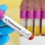 World Thalassemia Day 2024: ਕੀ ਹੈ ਥੈਲੇਸੀਮੀਆ ਬੀਮਾਰੀ ? ਜਾਣੋ ਇਸ ਦੇ ਲੱਛਣ ਤੇ ਰੋਕਥਾਮ