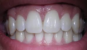 dental care