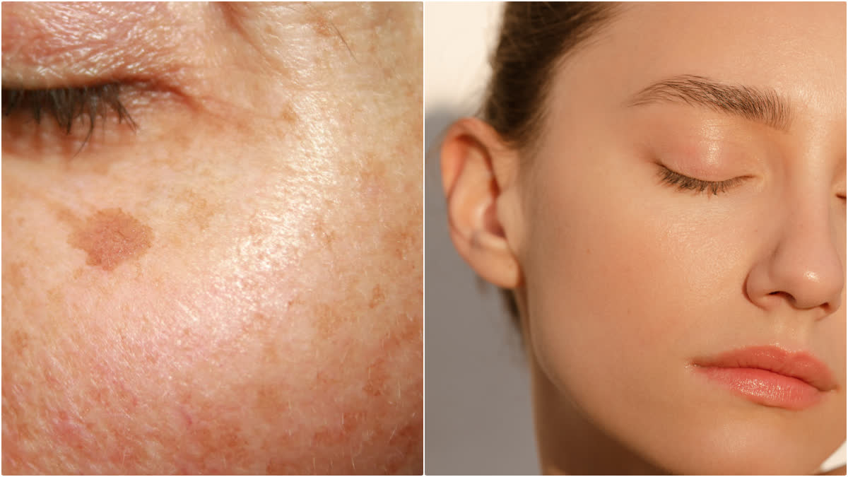 skincare