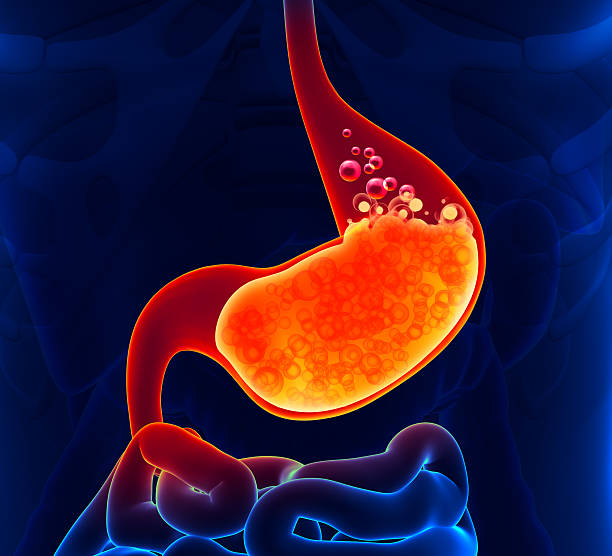 Acidity Relief