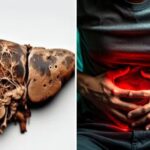 ਲੀਵਰ ਖਤਰੇ ‘ਚ: ਪੇਟ ਵਿੱਚ ਵੱਧ ਫੈਟ ਦੇ 5 ਸੰਕੇਤ, ਨਾ ਕਰੋਂ ਨਜ਼ਰਅੰਦਾਜ਼