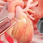 ਹਾਰਟ ਸਰਜਰੀ ਲਈ ਦੁਪਹਿਰ ਦਾ ਸਮਾਂ ਸਵੇਰ ਨਾਲੋਂ ਬਿਹਤਰ, ਖੋਜ ‘ਚ ਮਿਲੀ ਜਾਣਕਾਰੀ