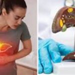 2050 ਤੱਕ 180 ਕਰੋੜ ਲੋਕ ਫੈਟੀ ਲਿਵਰ ਦੇ ਸ਼ਿਕਾਰ—ਇਹ 5 ਵੱਡੇ ਕਾਰਨ ਬਣ ਰਹੇ ਖ਼ਤਰਾ