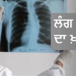 TB ਠੀਕ ਹੋਣ ਤੋਂ ਬਾਅਦ ਵੀ ਫੇਫੜਿਆਂ ’ਚ ਬਣਿਆ ਰਹਿ ਸਕਦਾ ਕੈਂਸਰ ਦਾ ਖ਼ਤਰਾ! ਡਾਕਟਰ ਤੋਂ ਜਾਣੋ ‘ਸਕਾਰ ਕੈਂਸਰ’ ਤੇ ਇਸ ਦੇ ਲੱਛਣ